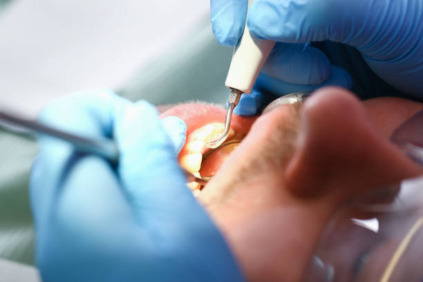 Best Emergency Dentist for Special Needs Patients in Keokea, HI