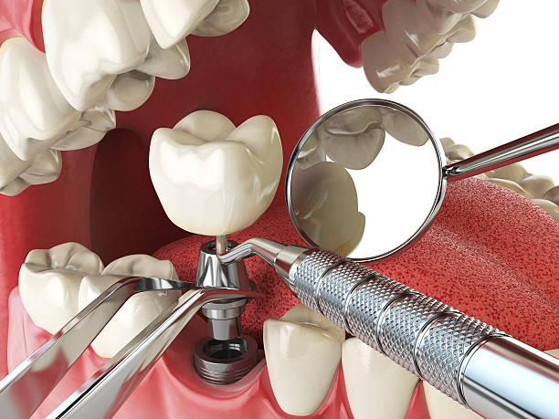 Best Emergency Dental Services for Seniors in Keokea, HI